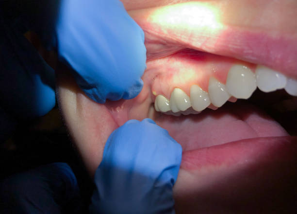 Best Emergency Treatment for Toothache in Ford City, PA