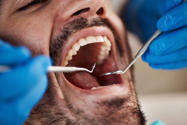 Best Emergency Broken Tooth Repair in Ford City, PA