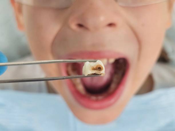 Best Pediatric Emergency Dentist in Ford City, PA